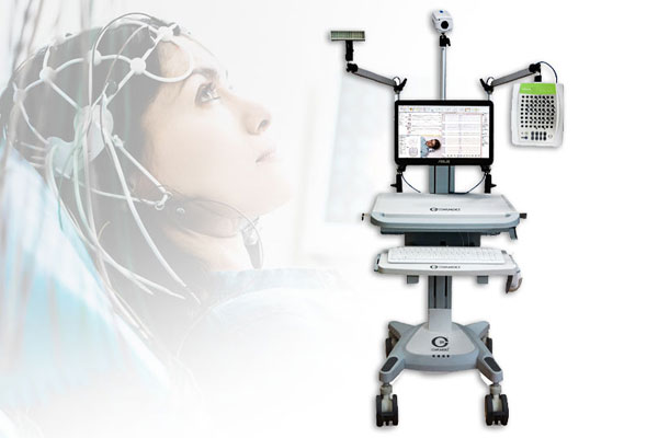 توريد جهاز تخطيط القلب الكهربائي (ECG)
